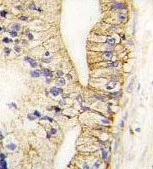 Immunohistochemistry (Formalin/PFA-fixed paraffin-embedded sections) - Anti-Cadherin 7 antibody - N-terminal (AB189965)