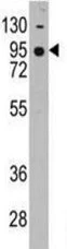 Western blot - Anti-Cadherin 7 antibody - N-terminal (AB189965)