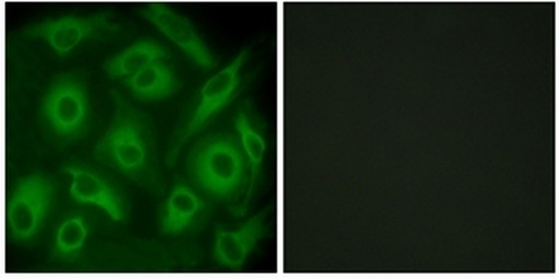 Immunocytochemistry/ Immunofluorescence - Anti-Cadherin like 23 antibody (AB131135)