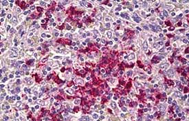 Immunohistochemistry (Formalin/PFA-fixed paraffin-embedded sections) - Anti-Cadherin like 23 antibody (AB131135)