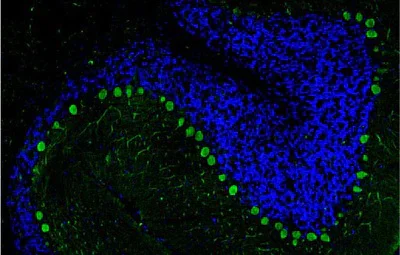 Immunohistochemistry (Formalin/PFA-fixed paraffin-embedded sections) - Anti-CALB1 antibody [L109/57] - Chicken IgY (Chimeric) (AB325663)
