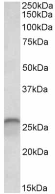 Western blot - Anti-Calbindin antibody (AB156812)
