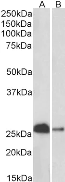 Western blot - Anti-Calbindin antibody (AB156812)