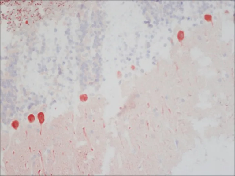 Immunohistochemistry (Formalin/PFA-fixed paraffin-embedded sections) - Anti-Calbindin antibody [CB-955] (AB82812)