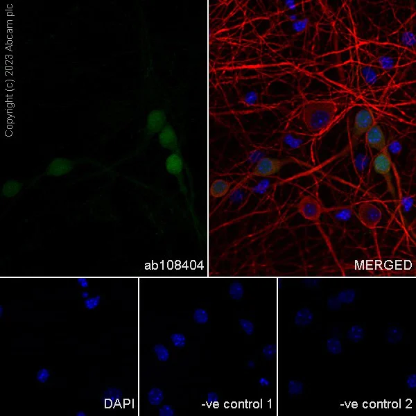 Immunocytochemistry/ Immunofluorescence - Anti-Calbindin antibody [EP3478] (AB108404)