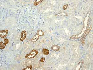 Immunohistochemistry (Formalin/PFA-fixed paraffin-embedded sections) - Anti-Calbindin antibody [EP3478] (AB108404)