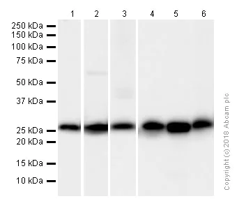 Western blot - Anti-Calbindin antibody [EP3478] (AB108404)