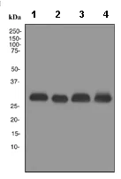 Western blot - Anti-Calbindin antibody [EP3478] (AB108404)