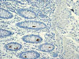 Immunohistochemistry (Formalin/PFA-fixed paraffin-embedded sections) - Anti-Calbindin antibody [EP3478] - BSA and Azide free (AB233018)