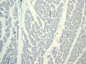 Immunohistochemistry (Formalin/PFA-fixed paraffin-embedded sections) - Anti-Calbindin antibody [EP3478] - BSA and Azide free (AB233018)