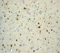 Immunohistochemistry (Formalin/PFA-fixed paraffin-embedded sections) - Anti-Calbindin antibody [EP3478] - BSA and Azide free (AB233018)