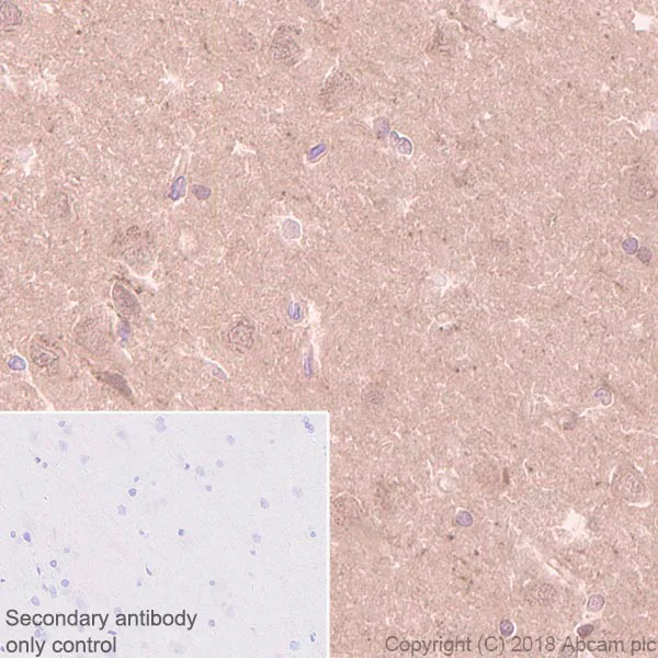 Immunohistochemistry (Formalin/PFA-fixed paraffin-embedded sections) - Anti-Calbindin antibody [EP3478] - BSA and Azide free (AB233018)