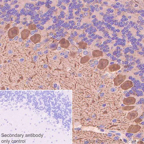 Immunohistochemistry (Formalin/PFA-fixed paraffin-embedded sections) - Anti-Calbindin antibody [EPR22698-236] (AB229915)