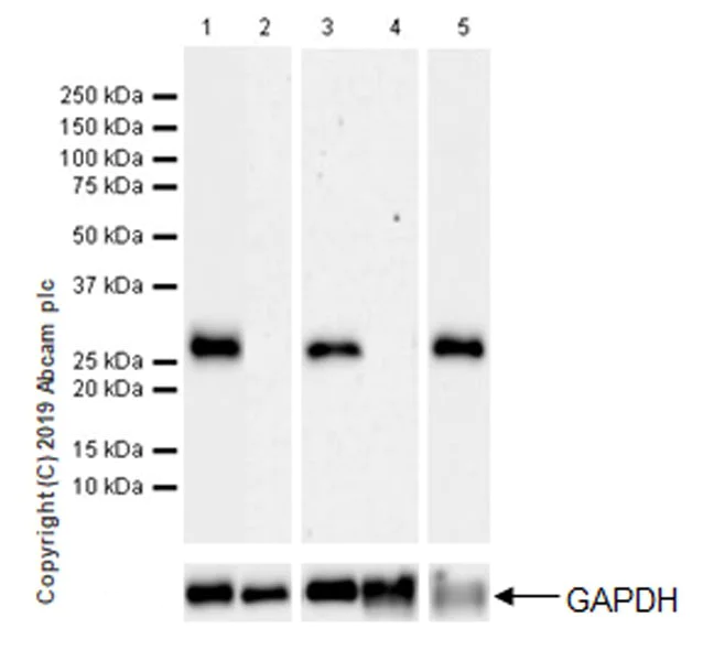 Western blot - Anti-Calbindin antibody [EPR22698-236] (AB229915)