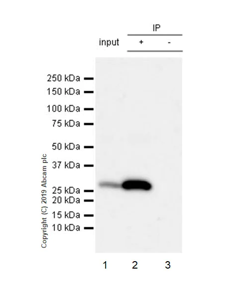 Immunoprecipitation - Anti-Calbindin antibody [EPR22698-236] - BSA and Azide free (AB255691)