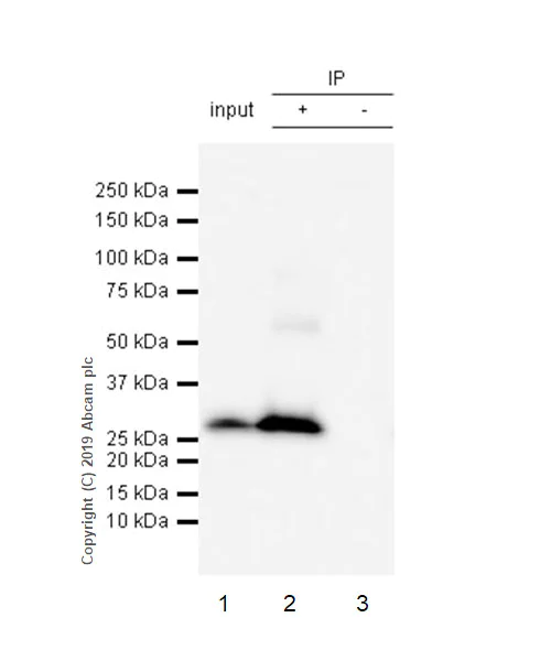 Immunoprecipitation - Anti-Calbindin antibody [EPR22698-236] - BSA and Azide free (AB255691)