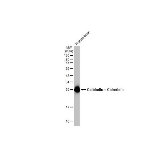 Western blot - Anti-Calbindin + Calretinin antibody [HL1787] (AB317108)