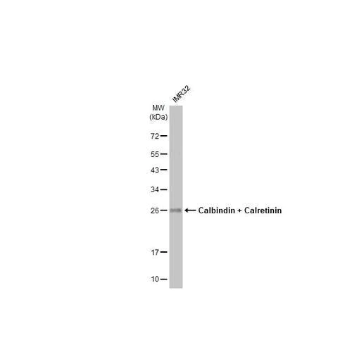 Western blot - Anti-Calbindin + Calretinin antibody [HL1787] (AB317108)
