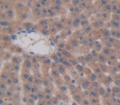 Immunohistochemistry (Formalin/PFA-fixed paraffin-embedded sections) - Anti-CALCB antibody (AB231662)