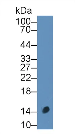 Western blot - Anti-CALCB antibody (AB231662)