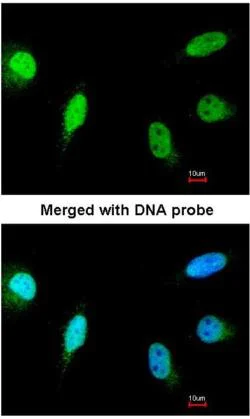 Immunocytochemistry/ Immunofluorescence - Anti-Calcineurin A antibody (AB137335)