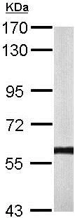 Western blot - Anti-Calcineurin A antibody (AB137335)