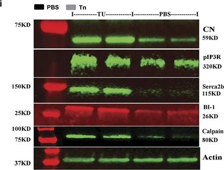 Western blot - Anti-Calcineurin A antibody (AB3673)