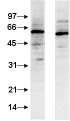 Western blot - Anti-Calcineurin A antibody (AB3673)