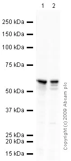 Western blot - Anti-Calcineurin A antibody (AB3673)