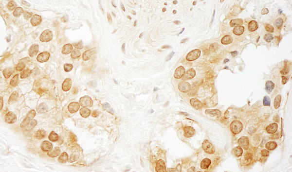 Immunohistochemistry (Formalin/PFA-fixed paraffin-embedded sections) - Anti-Calcineurin A antibody (AB71149)