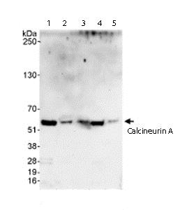 Western blot - Anti-Calcineurin A antibody (AB71149)