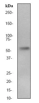 Western blot - Anti-Calcineurin A antibody [EP1669Y] (AB52761)