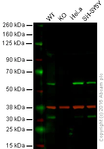 Western blot - Anti-Calcineurin A antibody [EP1669Y] (AB52761)