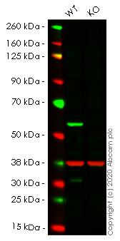 Western blot - Anti-Calcineurin A antibody [EP1669Y] - BSA and Azide free (AB239848), expandable thumbnail
