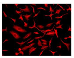 Immunocytochemistry/ Immunofluorescence - Anti-Calcineurin A antibody [EPR1670(2)] (AB109412), expandable thumbnail