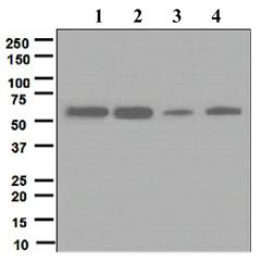 Western blot - Anti-Calcineurin A antibody [EPR1670(2)] (ab109412), expandable thumbnail
