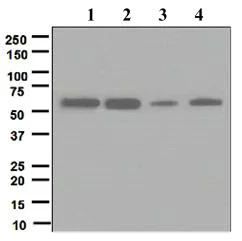 Western blot - Anti-Calcineurin A antibody [EPR1670(2)] (AB109412)