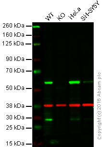 Western blot - Anti-Calcineurin A antibody [EPR1670(2)] (AB109412), expandable thumbnail