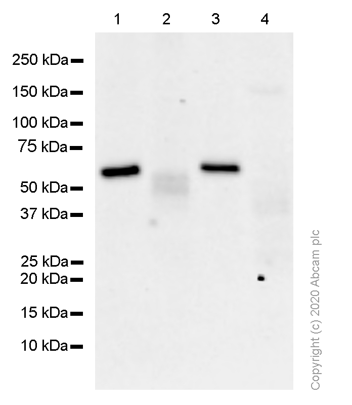 Western blot - Anti-Calcineurin A antibody [EPR1670(2)] - BSA and Azide free (AB239975)