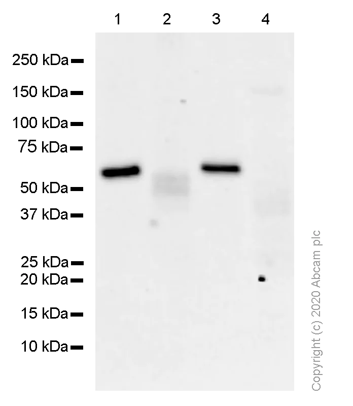 Western blot - Anti-Calcineurin A antibody [EPR1670(2)] - BSA and Azide free (AB239975)