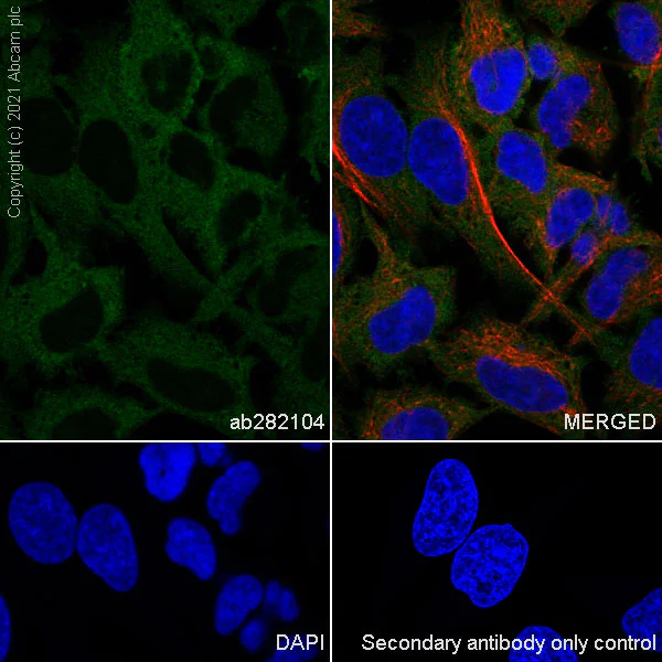 Immunocytochemistry/ Immunofluorescence - Anti-Calcineurin A antibody [EPR24997-22] (AB282104)