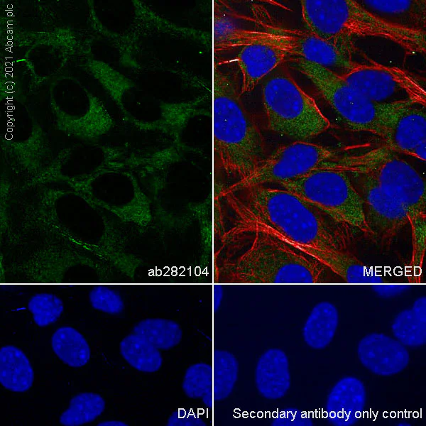 Immunocytochemistry/ Immunofluorescence - Anti-Calcineurin A antibody [EPR24997-22] (AB282104)