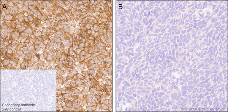Immunohistochemistry (Formalin/PFA-fixed paraffin-embedded sections) - Anti-Calcineurin A antibody [EPR24997-22] (AB282104)