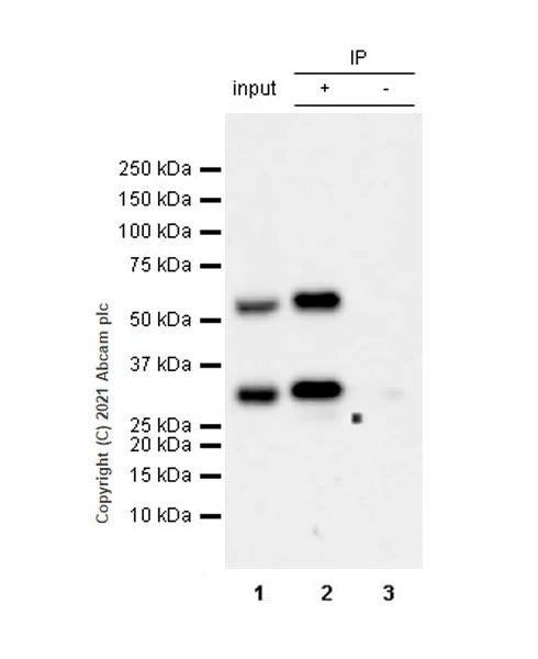 Immunoprecipitation - Anti-Calcineurin A antibody [EPR24997-22] (AB282104)
