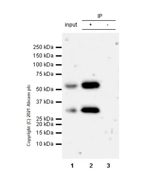 Immunoprecipitation - Anti-Calcineurin A antibody [EPR24997-22] (AB282104)