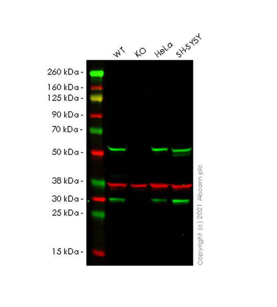 Western blot - Anti-Calcineurin A antibody [EPR24997-22] (AB282104)