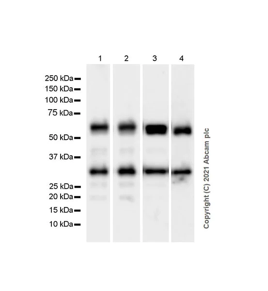 Western blot - Anti-Calcineurin A antibody [EPR24997-22] (AB282104)