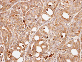 Immunohistochemistry (Formalin/PFA-fixed paraffin-embedded sections) - Anti-Calcineurin B/PPP3R1 antibody (AB154650), expandable thumbnail