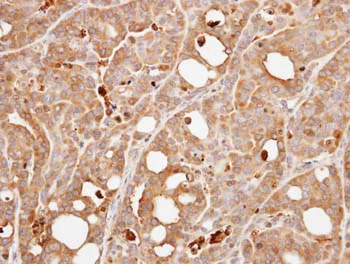 Immunohistochemistry (Formalin/PFA-fixed paraffin-embedded sections) - Anti-Calcineurin B/PPP3R1 antibody (AB154650)