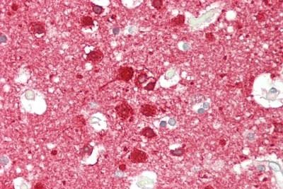 Immunohistochemistry (Formalin/PFA-fixed paraffin-embedded sections) - Anti-Calcineurin B/PPP3R1 antibody (AB230899), expandable thumbnail